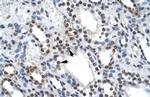 ILF2 Antibody in Immunohistochemistry (Paraffin) (IHC (P))