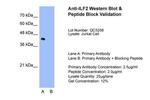 ILF2 Antibody in Western Blot (WB)