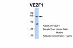 VEZF1 Antibody in Western Blot (WB)