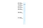 GTF3C3 Antibody in Western Blot (WB)