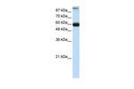 GTF3C5 Antibody in Western Blot (WB)