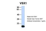 VSX1 Antibody in Western Blot (WB)