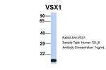 VSX1 Antibody in Western Blot (WB)