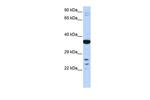 VSX1 Antibody in Western Blot (WB)