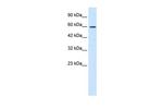 ZNF12 Antibody in Western Blot (WB)