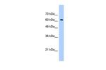 ZNF675 Antibody in Western Blot (WB)