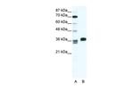 ESX1 Antibody in Western Blot (WB)