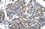 DHX9 Antibody in Immunohistochemistry (IHC)