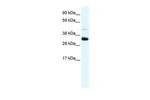 Annexin A3 Antibody in Western Blot (WB)