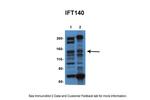 IFT140 Antibody in Western Blot (WB)