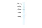 Connexin 30.3 Antibody in Western Blot (WB)