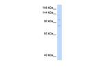 MCM8 Antibody in Western Blot (WB)