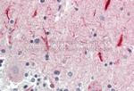 GABRG2 Antibody in Immunohistochemistry (Paraffin) (IHC (P))