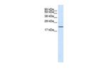 SCN3B Antibody in Western Blot (WB)