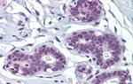 MAZ Antibody in Immunohistochemistry (IHC)