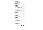 SOX4 Antibody in Western Blot (WB)