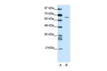 ZNF205 Antibody in Western Blot (WB)