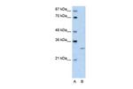 CREG1 Antibody in Western Blot (WB)