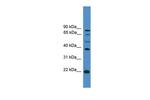 ASCL2 Antibody in Western Blot (WB)