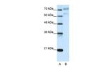 AATF Antibody in Western Blot (WB)