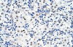 IKZF3 Antibody in Immunohistochemistry (IHC)