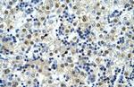 NFYC Antibody in Immunohistochemistry (IHC)