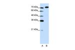 AKAP8L Antibody in Western Blot (WB)