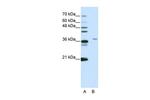 SART3 Antibody in Western Blot (WB)