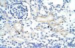 GTF2IRD1 Antibody in Immunohistochemistry (IHC)