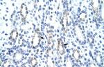 GTF2IRD1 Antibody in Immunohistochemistry (IHC)