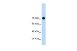 GTF2IRD1 Antibody in Western Blot (WB)