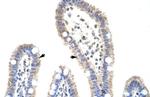 METTL3 Antibody in Immunohistochemistry (IHC)