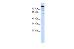 BACH2 Antibody in Western Blot (WB)