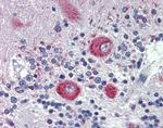 GRHL2 Antibody in Immunohistochemistry (Paraffin) (IHC (P))