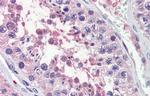 TRIM8 Antibody in Immunohistochemistry (IHC)