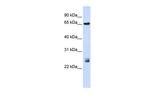 TRIM8 Antibody in Western Blot (WB)