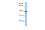 JAZF1 Antibody in Western Blot (WB)