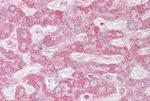 INSIG1 Antibody in Immunohistochemistry (IHC)