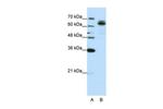 FXR1 Antibody in Western Blot (WB)