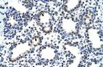 CARS Antibody in Immunohistochemistry (Paraffin) (IHC (P))