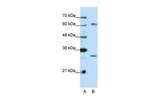 AUH Antibody in Western Blot (WB)