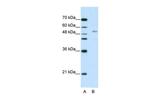 GRSF1 Antibody in Western Blot (WB)