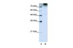 eIF3b Antibody in Western Blot (WB)