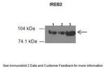 IREB2 Antibody in Western Blot (WB)