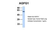 AGFG1 Antibody in Western Blot (WB)