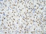 ILF3 Antibody in Immunohistochemistry (Paraffin) (IHC (P))