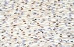 ILF3 Antibody in Immunohistochemistry (Paraffin) (IHC (P))