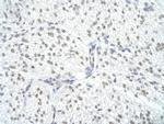 SNRPA Antibody in Immunohistochemistry (Paraffin) (IHC (P))