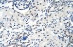 SNRPA Antibody in Immunohistochemistry (Paraffin) (IHC (P))