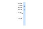 RRP9 Antibody in Western Blot (WB)